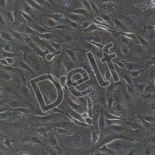 人原代主動(dòng)脈內(nèi)皮細(xì)胞