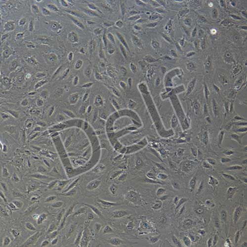 人主動脈內(nèi)皮細(xì)胞永生化-sv40