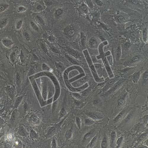 人主動脈內(nèi)皮細(xì)胞永生化-sv40