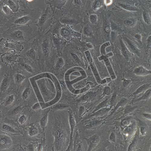 人主動脈內(nèi)皮細(xì)胞永生化-sv40