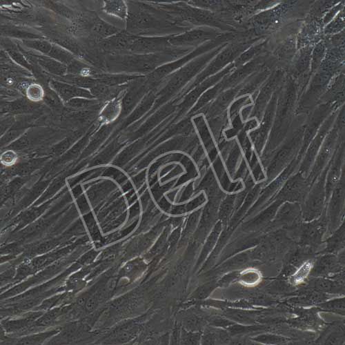 人原代主動(dòng)脈平滑肌細(xì)胞