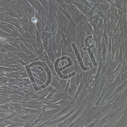 人原代主動脈外膜成纖維細胞