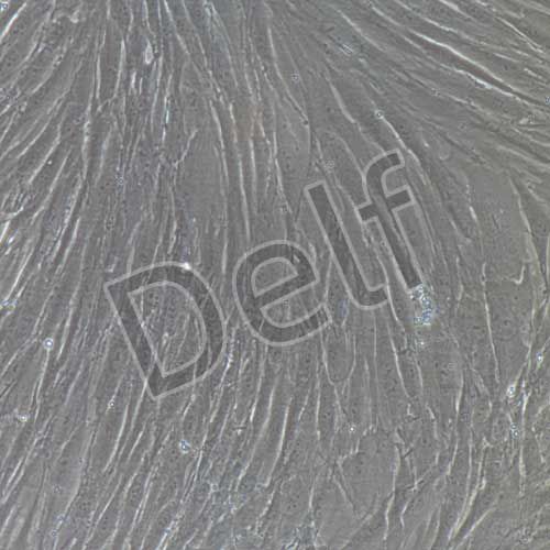 人原代主動脈外膜成纖維細胞