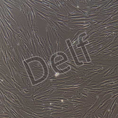 人原代子宮內(nèi)膜間質(zhì)細胞