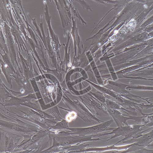 人原代子宮內(nèi)膜間質(zhì)細胞