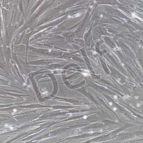 人原代子宮內(nèi)膜間質(zhì)細胞