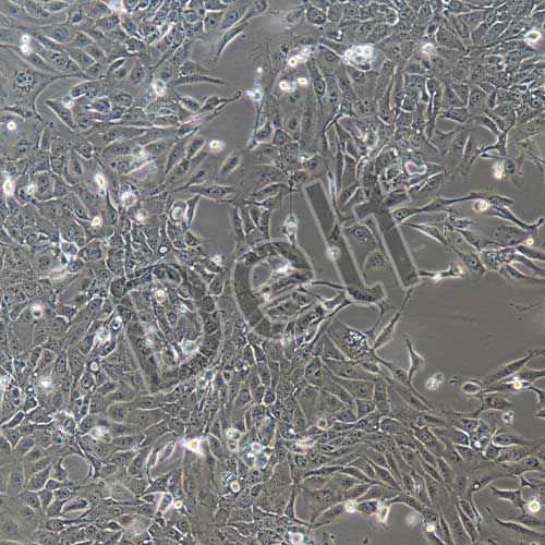 人原代子宮內(nèi)膜上皮細(xì)胞