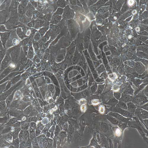 人原代子宮內(nèi)膜上皮細(xì)胞