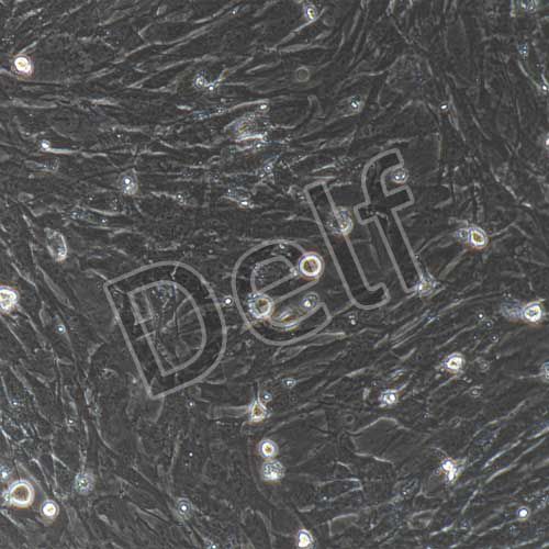 小鼠原代膀胱基質(zhì)成纖維細(xì)胞