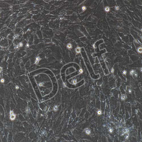 小鼠原代膀胱基質(zhì)成纖維細(xì)胞