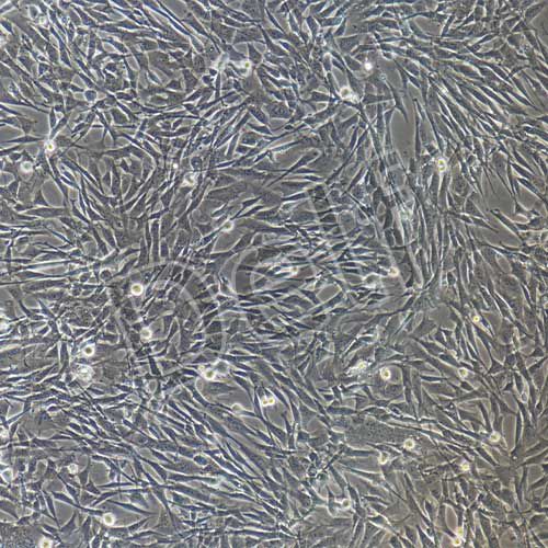 小鼠肺成纖維細(xì)胞永生化