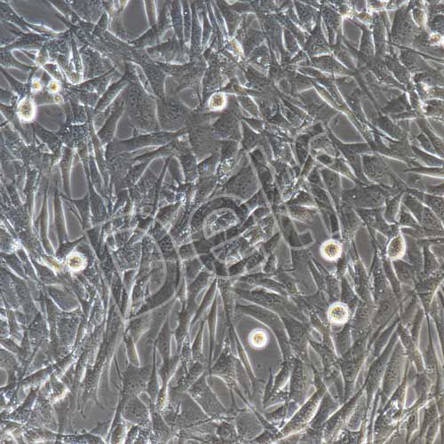 小鼠肺成纖維細(xì)胞永生化