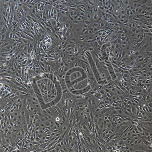 小鼠原代肺動(dòng)脈內(nèi)皮細(xì)胞