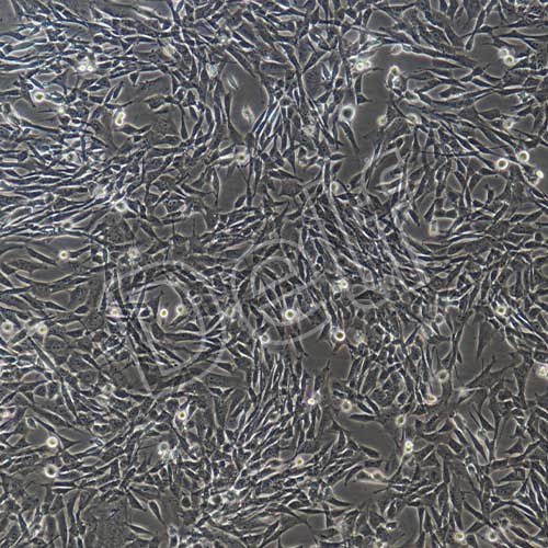 小鼠肺動脈平滑肌細(xì)胞永生化