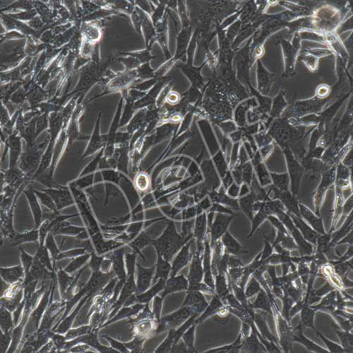 小鼠肺動脈平滑肌細(xì)胞永生化