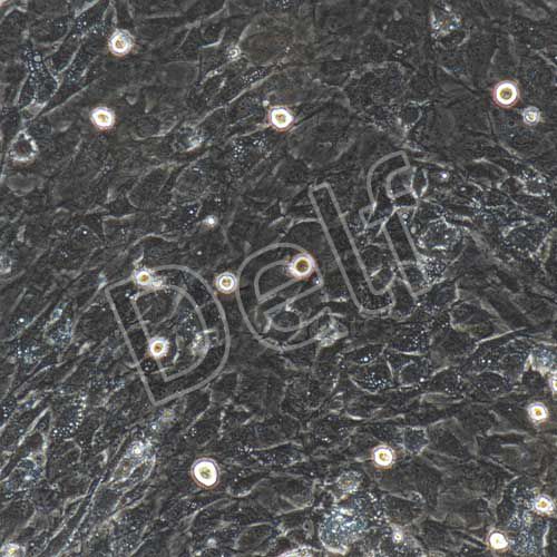 小鼠原代骨骼肌細胞