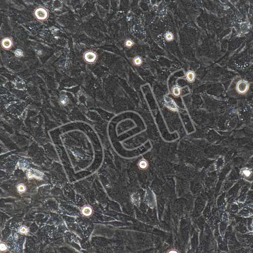 小鼠原代骨骼肌細胞