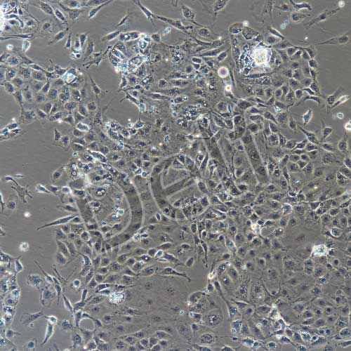 小鼠原代冠狀動脈內(nèi)皮細胞
