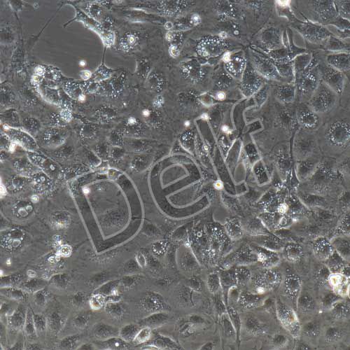 小鼠原代冠狀動脈內(nèi)皮細胞