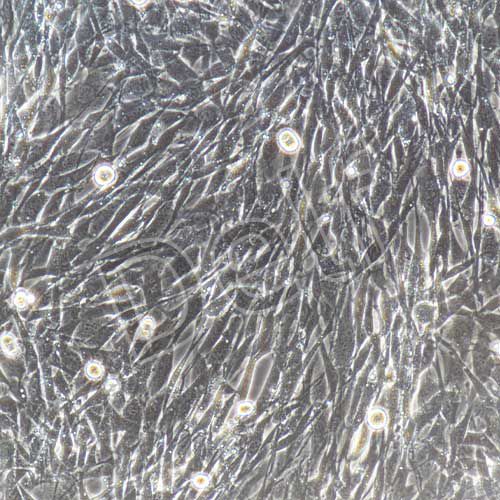 小鼠卵巢顆粒細(xì)胞永生化-sv40