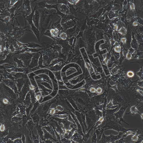 小鼠內(nèi)皮祖細(xì)胞永生化