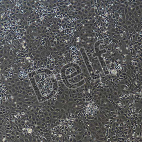 小鼠原代視網膜微血管內皮細胞