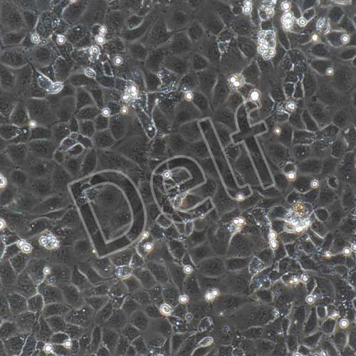 小鼠原代視網膜微血管內皮細胞