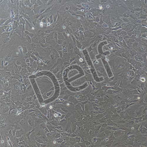 小鼠原代視網(wǎng)膜微血管周細(xì)胞