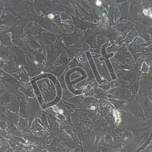 小鼠原代視網(wǎng)膜微血管周細(xì)胞