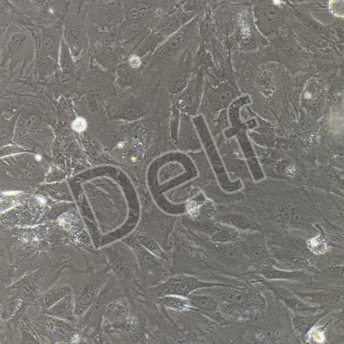 小鼠原代視網(wǎng)膜微血管周細(xì)胞