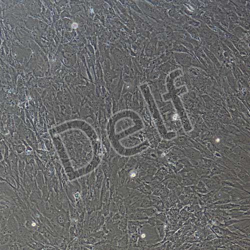 小鼠原代心肌成纖維細(xì)胞