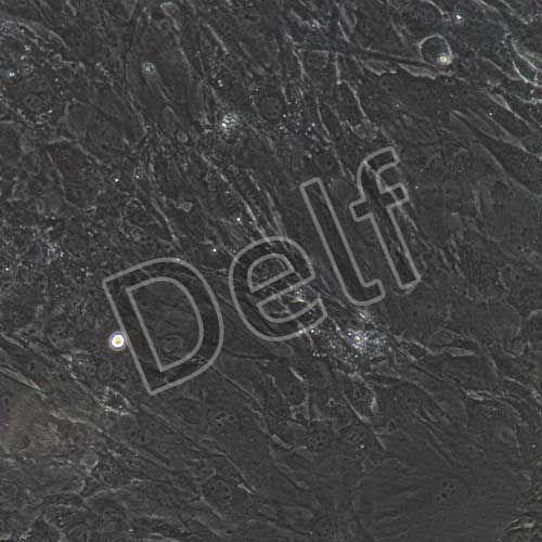 小鼠原代心肌成纖維細(xì)胞