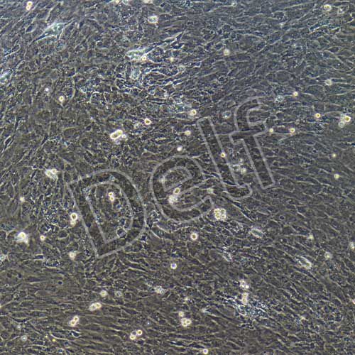 小鼠原代主動脈瓣膜間質(zhì)細(xì)胞