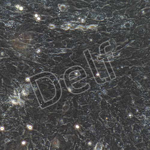 小鼠原代主動脈瓣膜間質(zhì)細(xì)胞