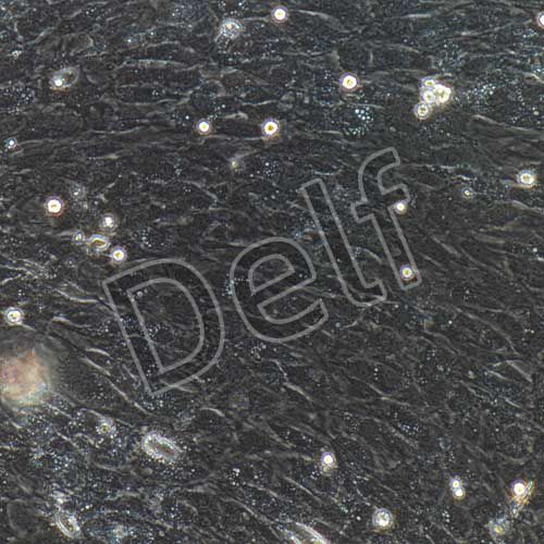 小鼠原代主動脈瓣膜間質(zhì)細(xì)胞