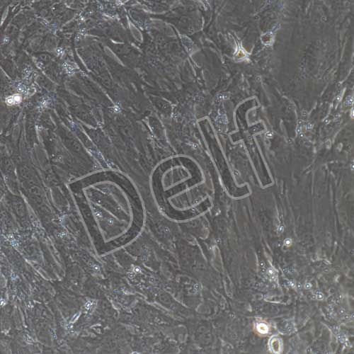 小鼠原代子宮內(nèi)膜基質(zhì)細(xì)胞