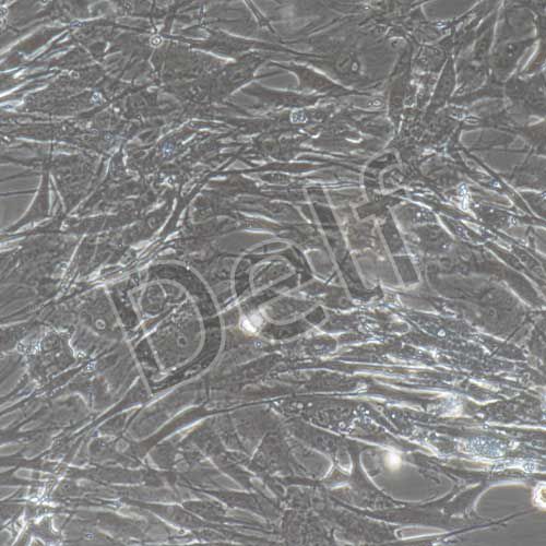 豬原代主動脈瓣膜間質細胞