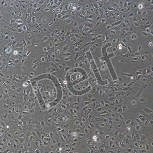 豬子宮內(nèi)膜上皮細(xì)胞永生化