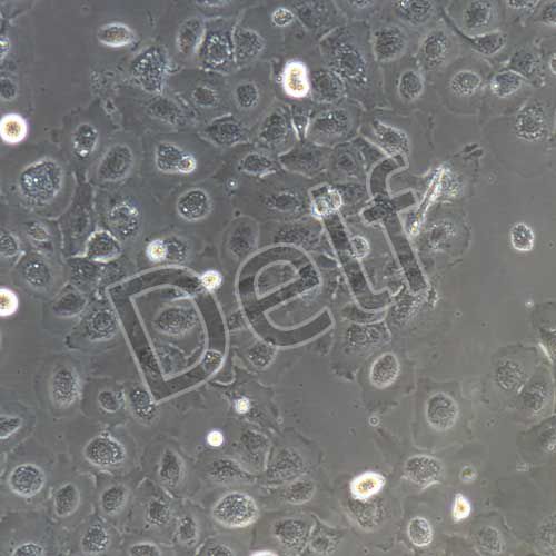 豬子宮內(nèi)膜上皮細(xì)胞永生化