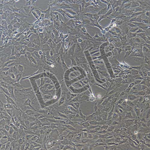 HUVEC+GFP 人臍靜脈內(nèi)皮細(xì)胞永生化+GFP