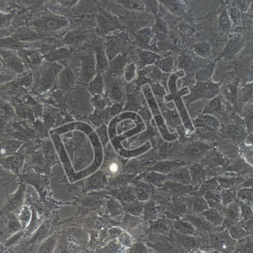 HUVEC+GFP 人臍靜脈內(nèi)皮細(xì)胞永生化+GFP