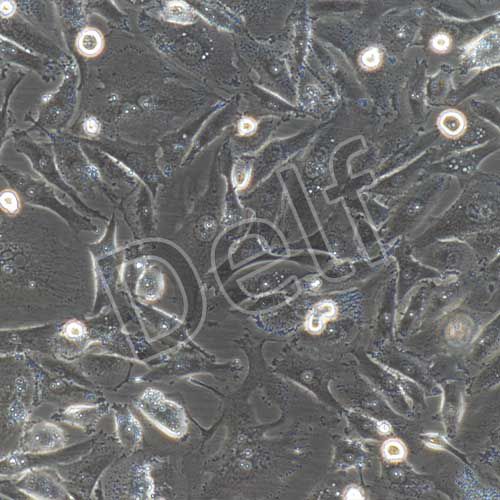 MDA-MB-231+GFP 人乳腺癌細(xì)胞+GFP