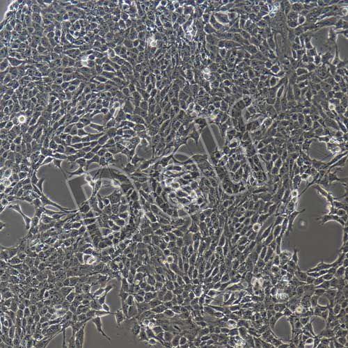 4T1-luc 小鼠乳腺癌細(xì)胞熒光素酶標(biāo)記