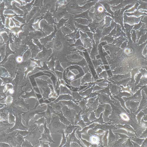 A549+luc 人肺癌細(xì)胞+luc