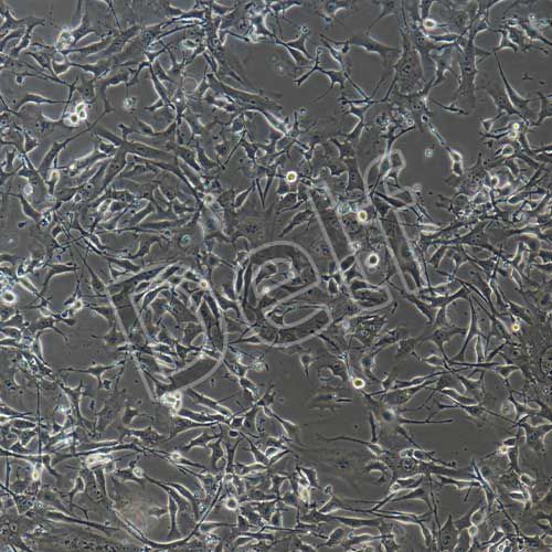 B16-F10+luc 小鼠黑色素瘤細胞熒光素酶標記