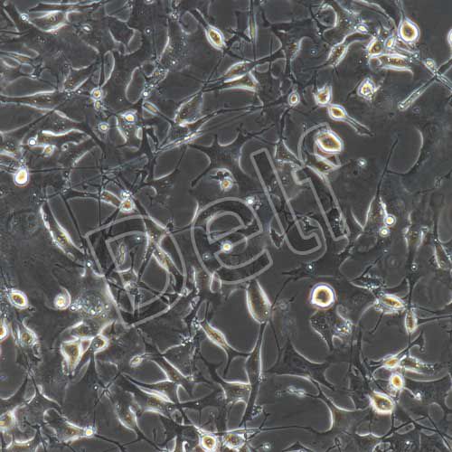 B16-F10+luc 小鼠黑色素瘤細胞熒光素酶標記