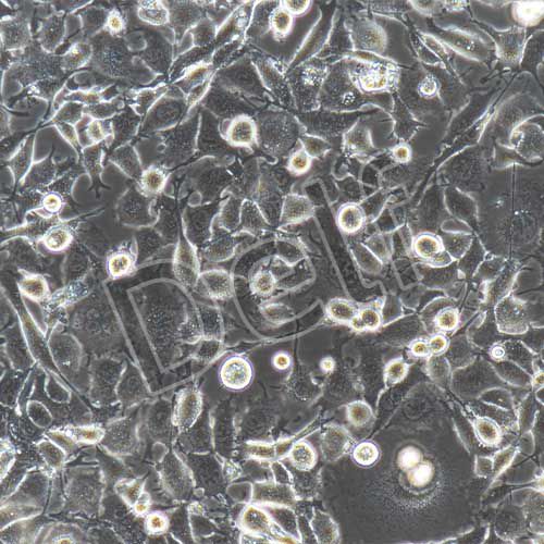 GL261+luc 小鼠膠質(zhì)細(xì)胞瘤+luc