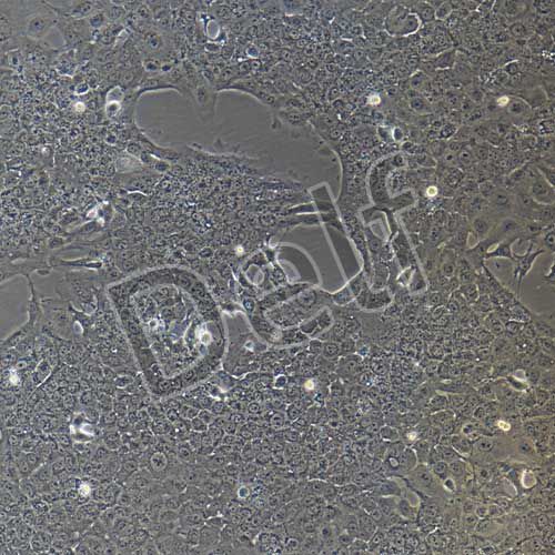 HCC827+luc 人非小細(xì)胞肺癌細(xì)胞熒光素酶標(biāo)記