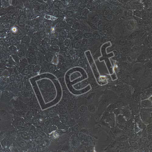 HCC827+luc 人非小細(xì)胞肺癌細(xì)胞熒光素酶標(biāo)記