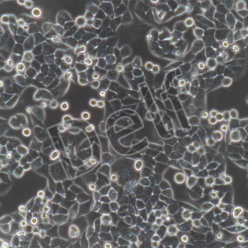HELA+luc 人宮頸癌細胞HELA熒光素酶標(biāo)記